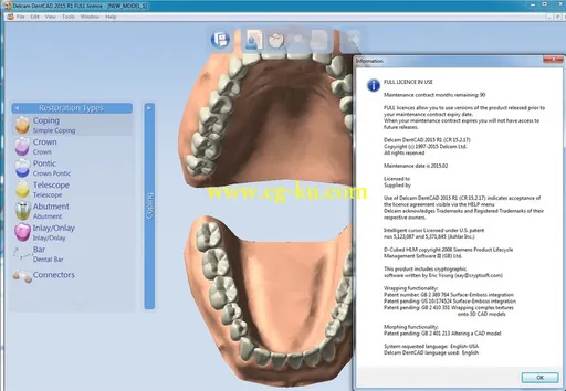 Delcam DentCAD 2015 R1 Win32/64的图片2