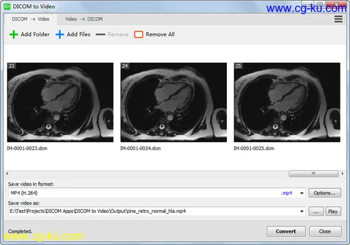 DICOM to Video 1.11.0的图片1