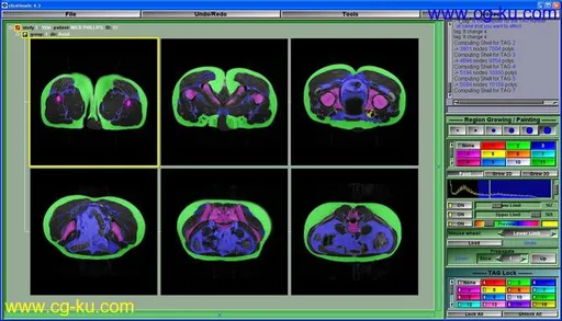 Tomovision sliceOmatic 5.0 Rev-9 x64的图片1