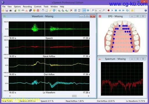 RoseMedical icSpeech Professional Edition 3.3.0的图片1