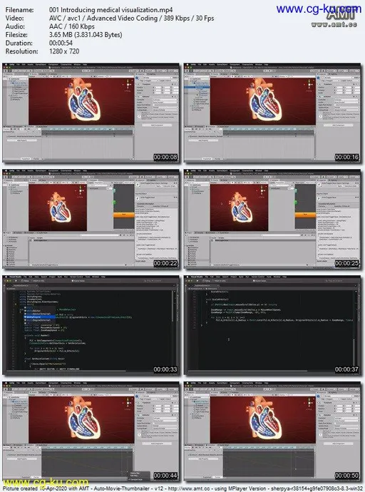 Unity Medical Visualization: 03 Deployment and Usability的图片1