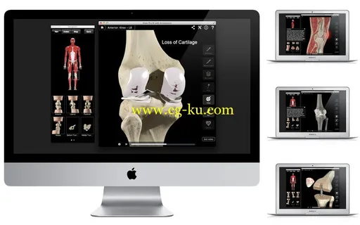 Knee Pro III with Animations v3.8 MacOSX的图片1