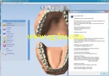 Delcam DentCAD 2015 R1 Win32/64的图片2