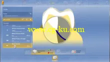 CEREC 4.4 Training Video (2015)的图片2