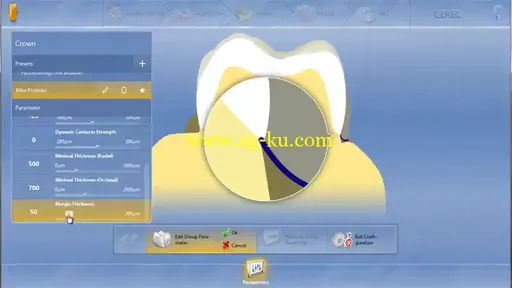 CEREC 4.4 Training Video (2015)的图片3