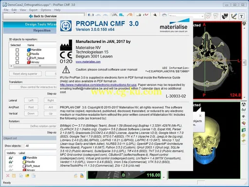 Materialise ProPlan CMF 3.0的图片2