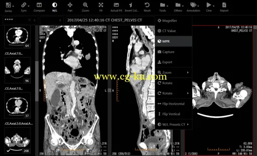 JIUN Corporation SonicDICOM PACS 3.0.0.51的图片1