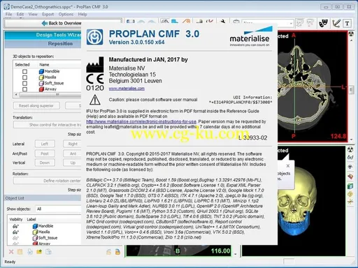 Materialise ProPlan CMF 3.0.1的图片2