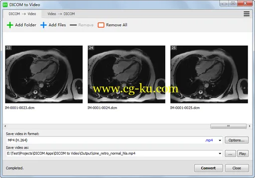 DICOM to Video 1.11.0的图片1