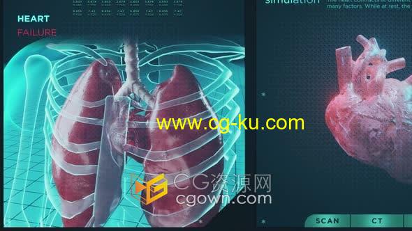 视频素材-HUD信息图心力衰竭功能心脏病疾病医学医疗保健系统屏幕全息概念的图片1